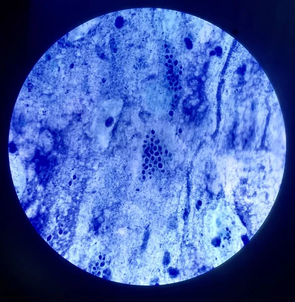 Bakteriecell Vid Gramfärgning — Stockfoto