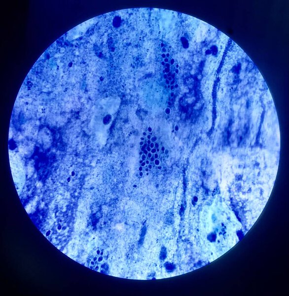 Bacteria cell in Gram stain.