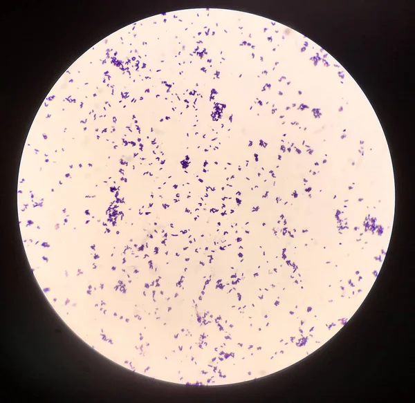 Célula Bacteriana Coloração Gram — Fotografia de Stock