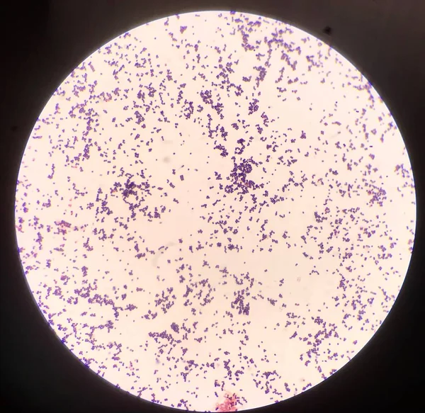 Cellula Batterica Nella Macchia Gram — Foto Stock