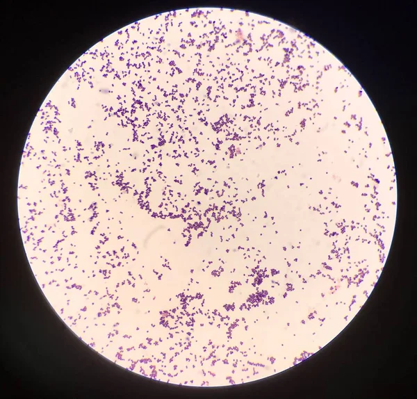 Bacteria Cell Gram Stain — Stock Photo, Image