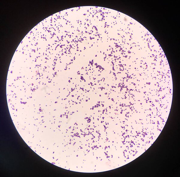 Bacteria cell in Gram stain.