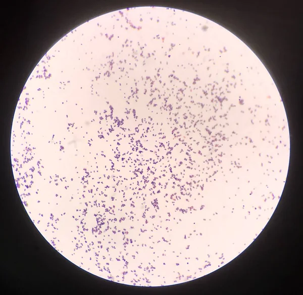 Bacteria Cell Gram Stain — Stock Photo, Image