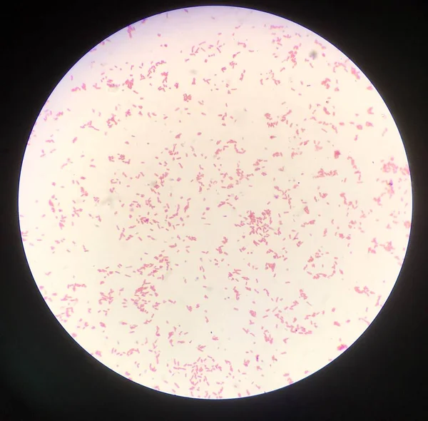 Célula Bacteriana Tinción Gram — Foto de Stock