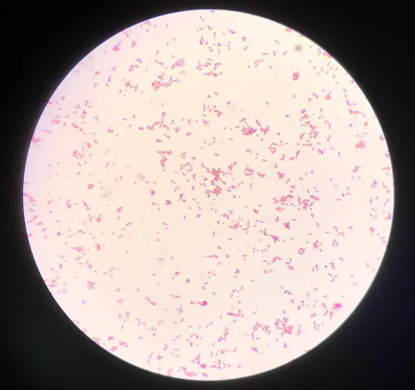 Célula Bacteriana Coloração Gram — Fotografia de Stock