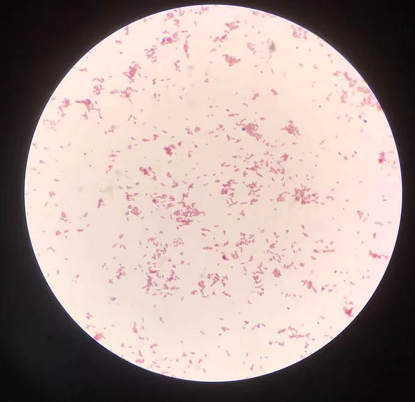 Bakterienzelle Gramm Fleck — Stockfoto