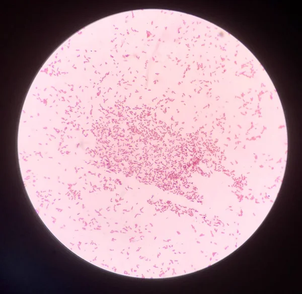 Bacteria Cell Gram Stain — Stock Photo, Image