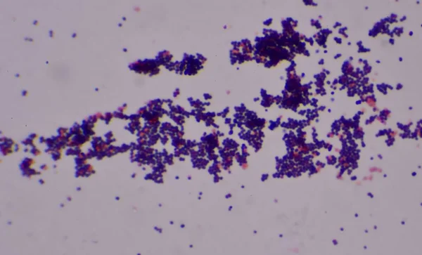 Gram Positive Cocci Finding Microscope Lab — Stock Photo, Image