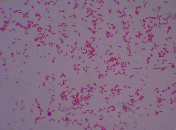 Gram Négatif Bacilles Avec Bipola Recherche Taches Microscope — Photo