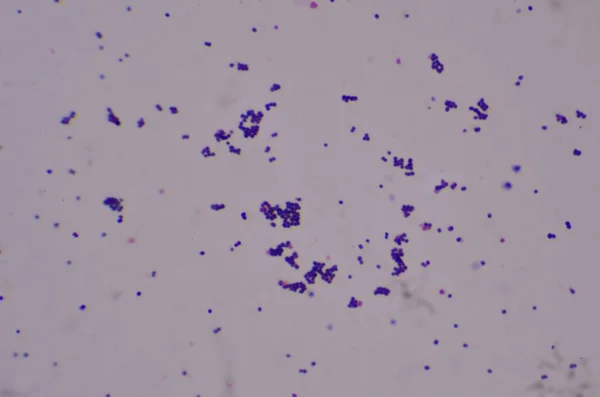 Rilevamento Cocchi Gram Positivi Con Microscopio Laboratorio — Foto Stock