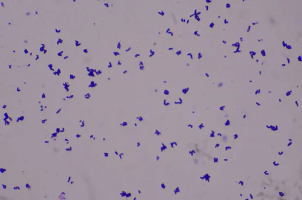 Gramo Positivo Baclli Chines Carta Hallazgo Con Microscopio Laboratorio — Foto de Stock