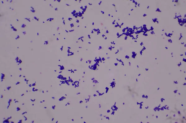 Gramo Positivo Baclli Chines Carta Hallazgo Con Microscopio Laboratorio — Foto de Stock