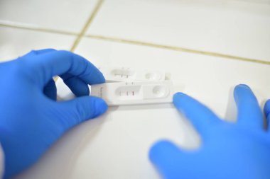 El tıbbi teknisyeni covid-19 antijen testinin pozitif çıktığını doğruladı..
