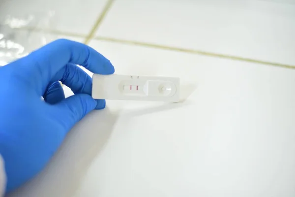 Espera Positiva Antígeno Covid Teste Tecnólogo Médico Mão Confirma Pela — Fotografia de Stock
