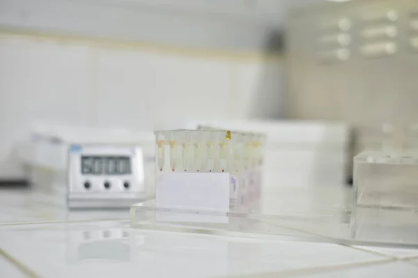 血液バンク実験室でのゲルカラム凝集試験 — ストック写真