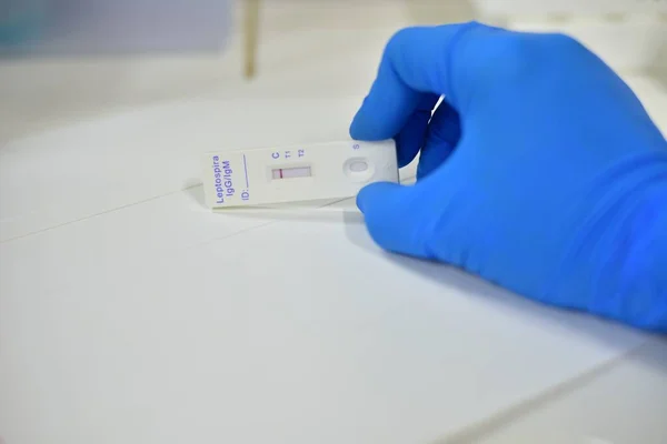 Cientista Mão Laboratório Teste Luva Azul Fundo Desfocado — Fotografia de Stock