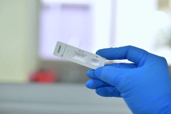 Científico Mano Laboratorio Pruebas Guantes Azules Sobre Fondo Borroso —  Fotos de Stock