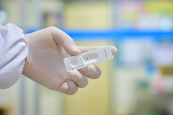 Teste Tira Antigénio Covid Positivo Laboratório — Fotografia de Stock