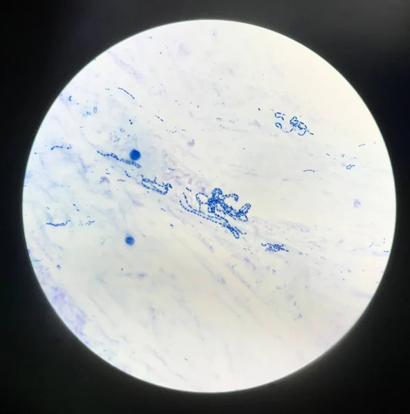 Cierre Las Células Bacterias Azules Con Microscopio — Foto de Stock