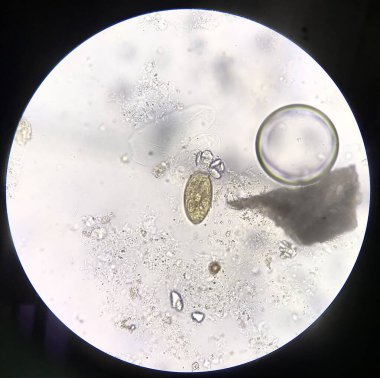 Dışkı muayenesinde paraziti kapat.