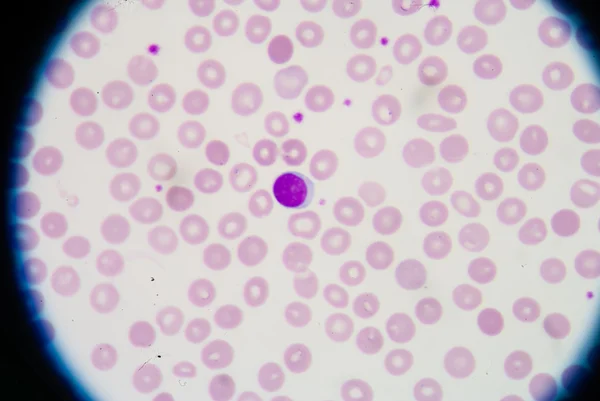 Blood smear — Stock Photo, Image