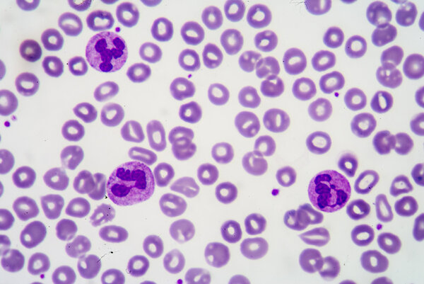 Blood smear