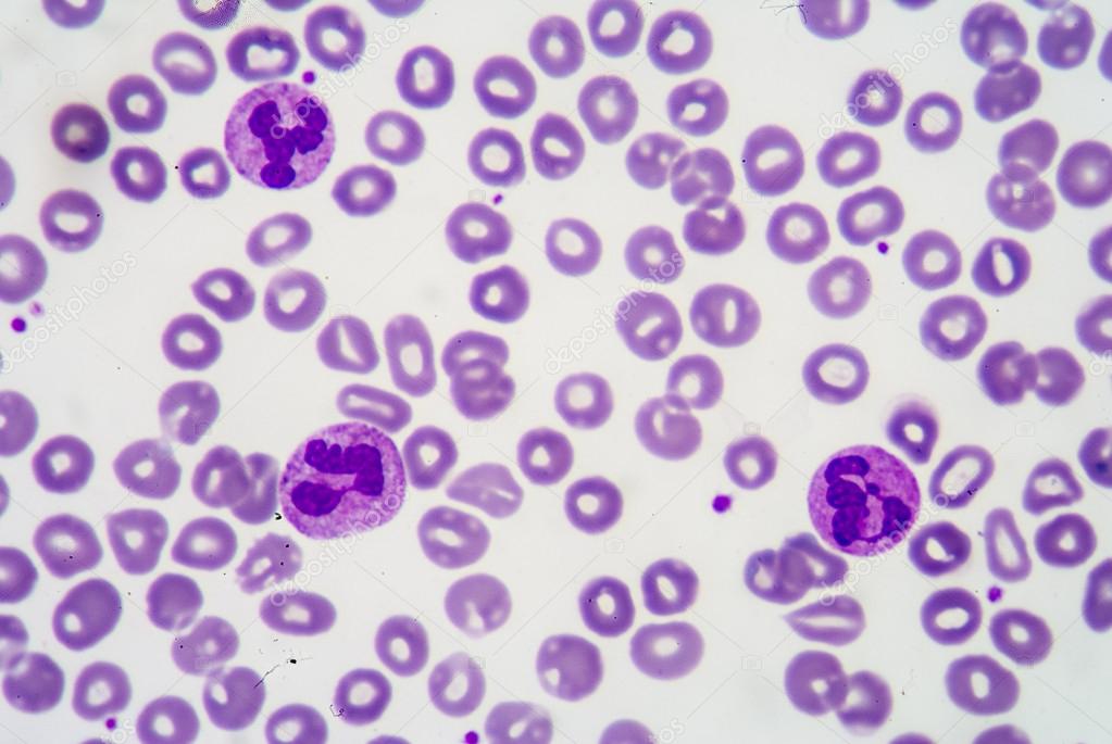 Blood smear