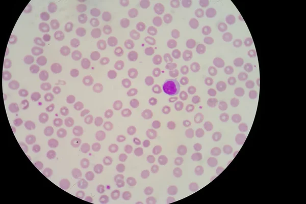 Lymphocytes — Photo