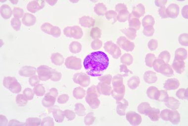 metamyelocyte