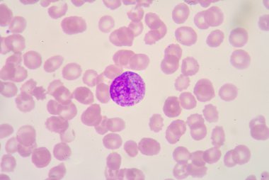 metamyelocyte