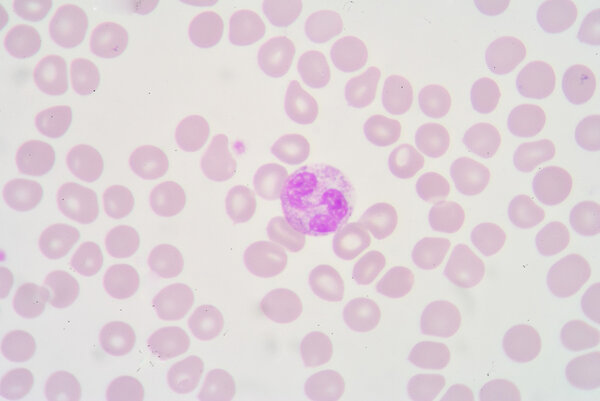 Neutrophil