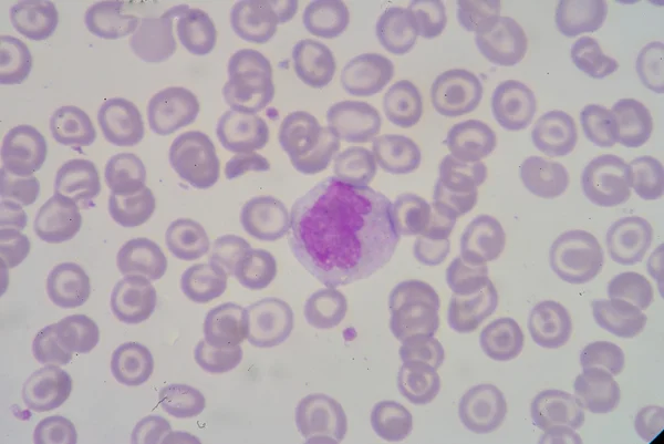 Monocyte