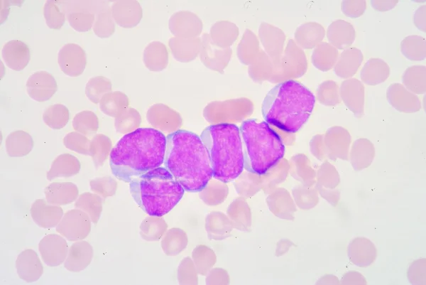 myeloblast