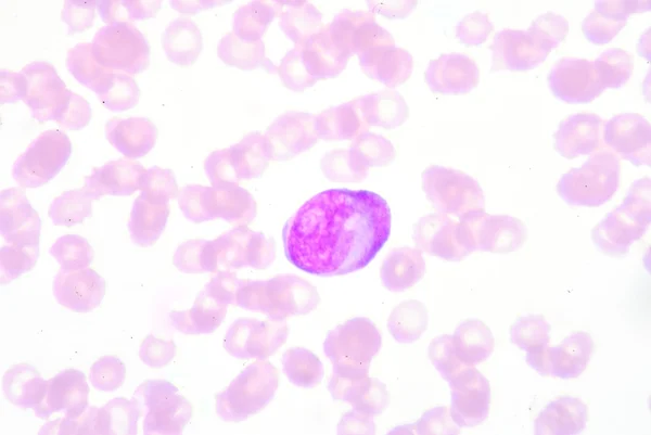 Metamyelocyte — Stockfoto