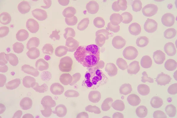 Neutrophil & Eosinophil — стоковое фото