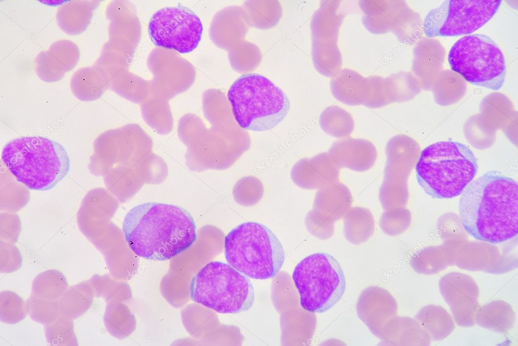 Lymphoblast