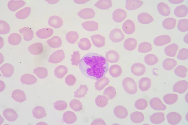 Monocyte — Stock Photo, Image