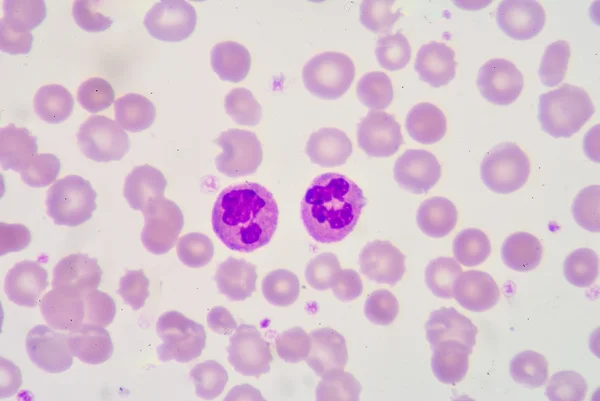 Neutrophil — Stock Photo, Image