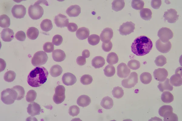 Neutrophil — Stock Fotó