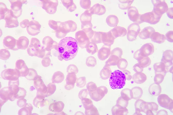 Neutrophil&Basophil — Stock Photo, Image