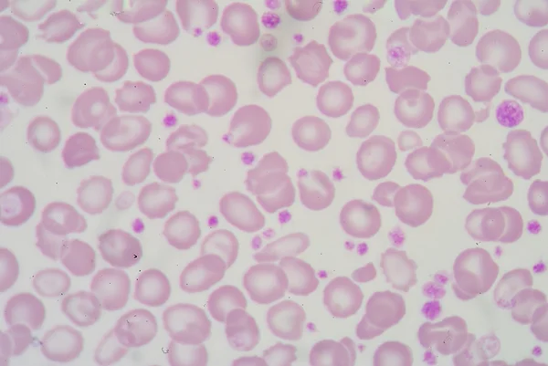 Giant platelet — Stock Photo, Image