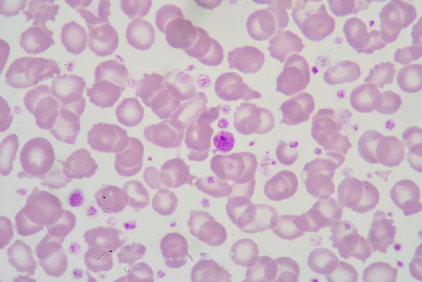 Giant platelet — Stock Photo, Image