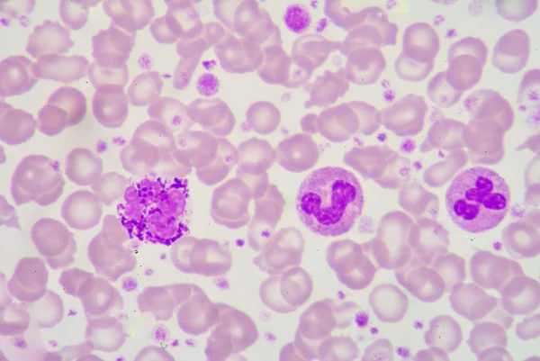 Neutrophil & Basophil — стоковое фото