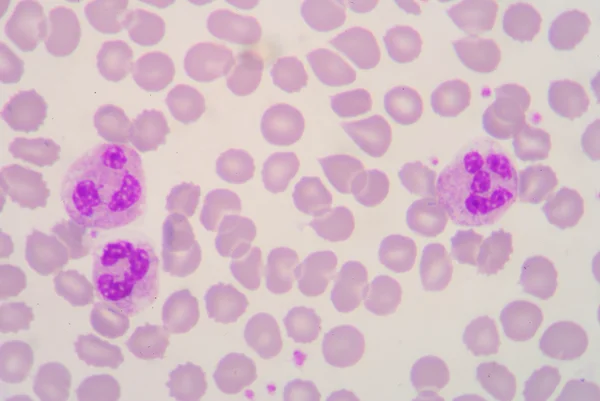 Neutrophil — Stock Photo, Image