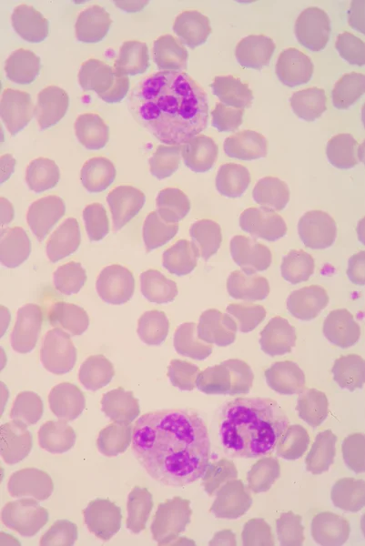 Neutrophil — Stock Photo, Image