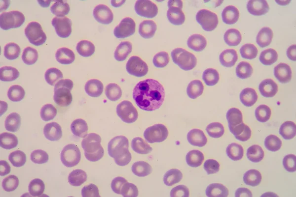 Neutrophil — Stock Photo, Image