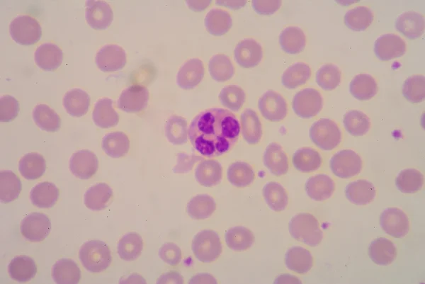 Neutrophil — Stock Fotó