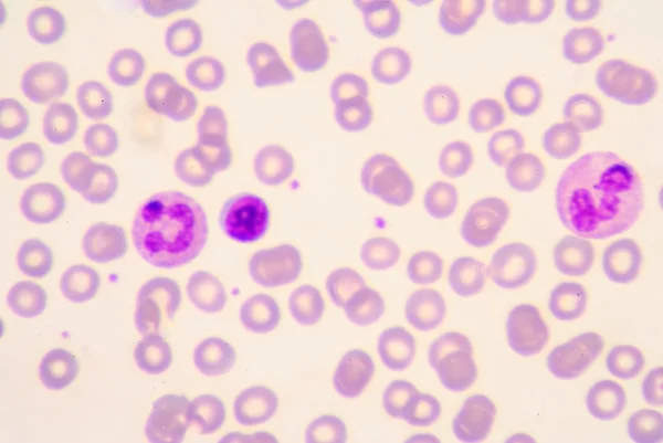 Neutrophil and lymphocyte — Stock Photo, Image