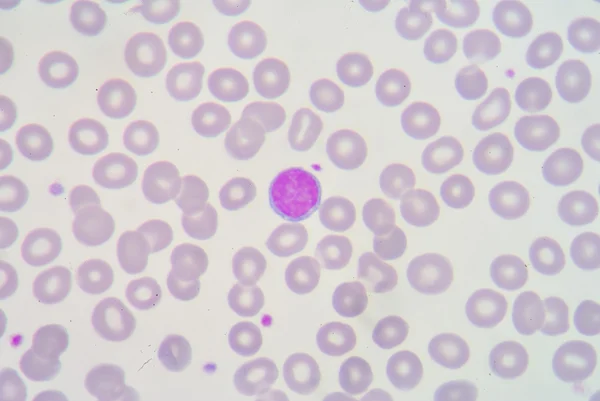 Λεμφοκυττάρων — Φωτογραφία Αρχείου