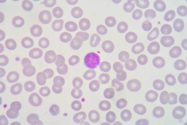 Lymphocyte — Stock Photo, Image